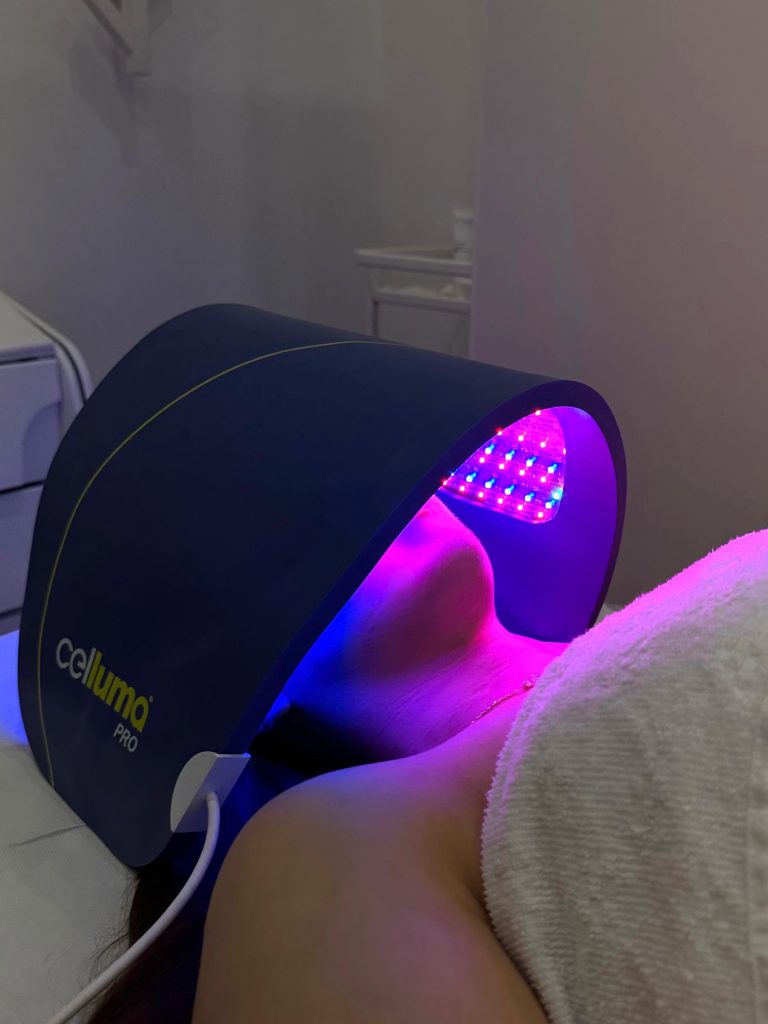 Celluma LED terapija