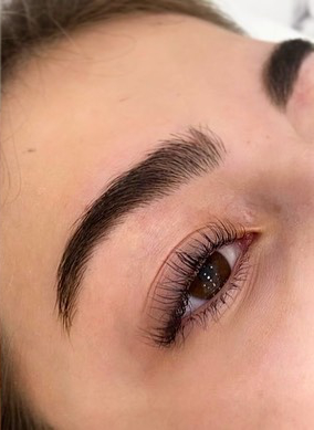 Obrve nakon brow lifta